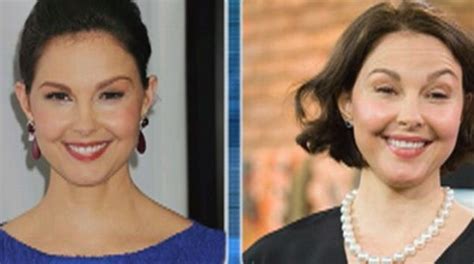 Ashley Judd Before And After Plastic Surgery 2 Celebrity Plastic