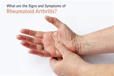 What Are The Signs And Symptoms Of Rheumatoid Arthritis Jindal