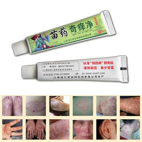 Buy 5pcs Al Antibacterial Anti Cream Dermatitis Eczema Psoriasis Cream