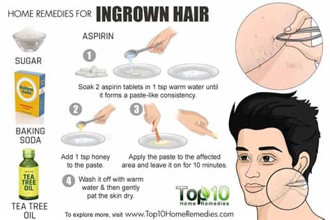 This article, will attempt to cover in details the symptoms of ingrown underarm hair, its cause and ways to get rid, treat, remove and home remedies. Home Remedies for Ingrown Hair | Top 10 Home Remedies
