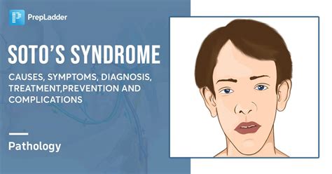 Sotos Syndrome Causes Symptoms Diagnosis Treatment Prevention And