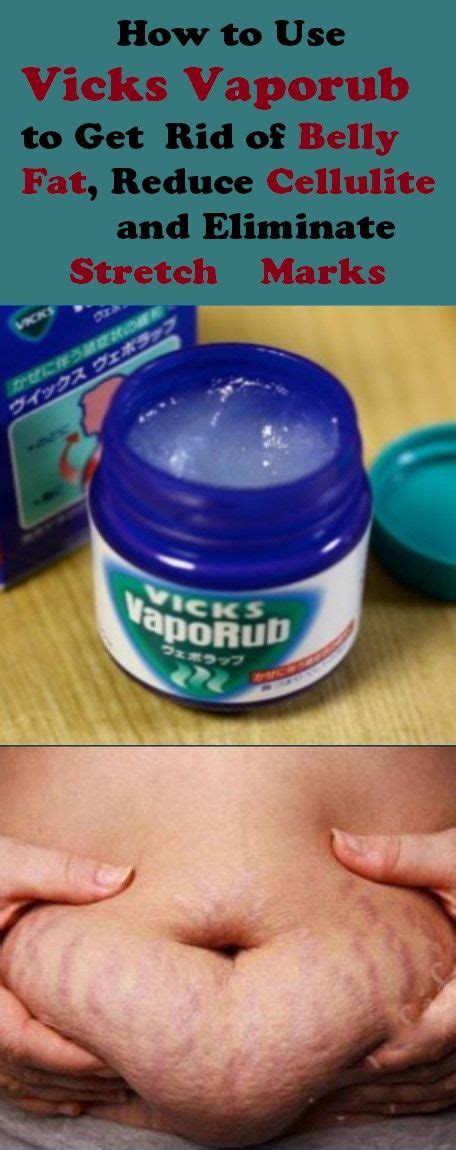One way of treating toenail fungus is vicks® vaporub®. My tried and true secret! I even mix a little pure cocoa ...