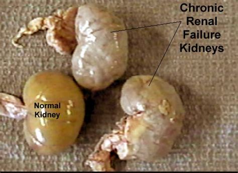 Results from an international comparative study. Chronic Renal Failure | Renal Treatment Centers