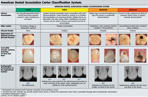 Caries Table