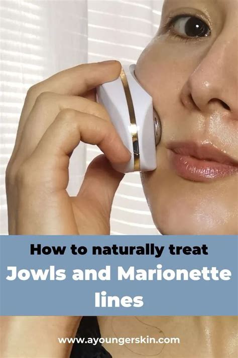 Jowls And Marionette Lines Treatment How To Get Rid Of Marionette