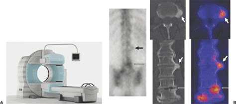 Basics Of Ct Scanning And Issues Relevant To Integrated Imaging