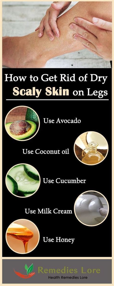 How To Get Rid Of Scaly Skin On Legs Scalyskin Remedieslore