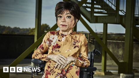 Broadcasters Commit To Doubling Disabled Employees By 2020 Bbc News