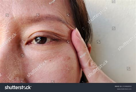 Portrait Showing Finger Holding Flabbiness Flabby Stock Photo