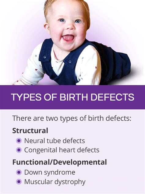Birth Defects Shecares