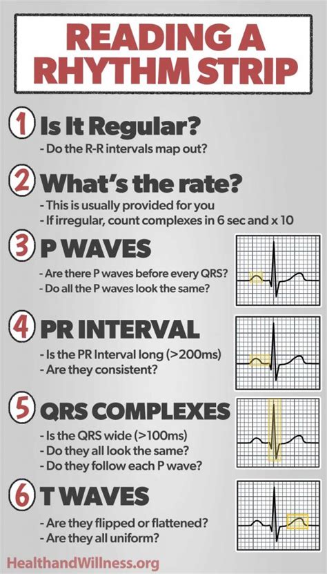 How To Read An EKG Rhythm Strip Health And Willness