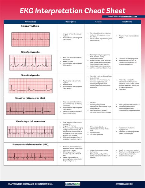 Ecg Abnormalities Chart Understanding The Signs And Symptoms Dona