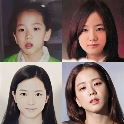 Blackpink Plastic Surgery Before And After Before And After