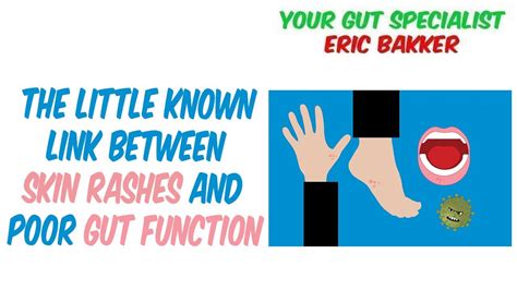 The Little Known Link Between Skin Rashes And Poor Gut Function