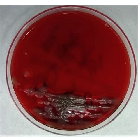 Blood Culture Shows Gram Positive Rod Shaped Bacteria Download