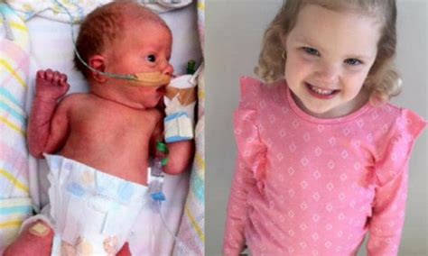 Premature Babies Then And Now Photos Kidspot