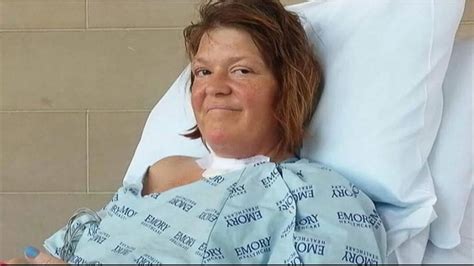 Georgia Womans Long Road To Recovery From Flesh Eating Bacteria