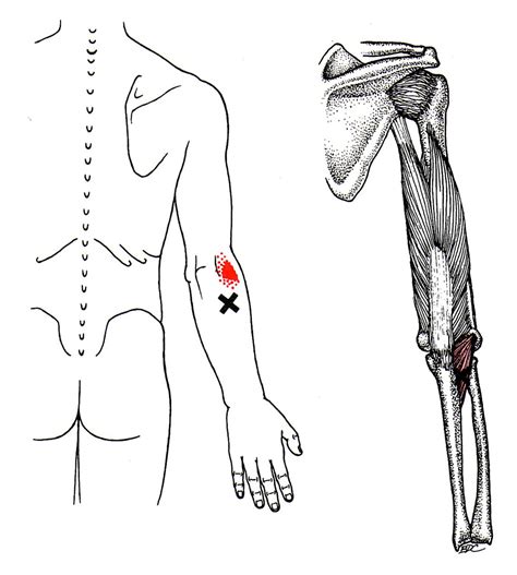 The Trigger Point Referred Pain Guide