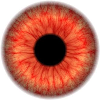 Discover why weed gives you bloodshot eyes. 'Why Are My Eyes Red All the Time?' - Common Causes of ...