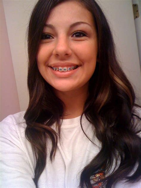 Girls With Braces On Twitter Doesnt Her Colored Braces Look Cute Braces