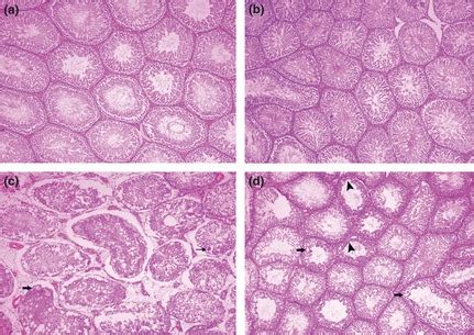 Photomicrographs Showing Normal Histological Appearance Of Testis