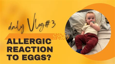 Allergic Reaction To Eggs Daily Vlog 3 Youtube