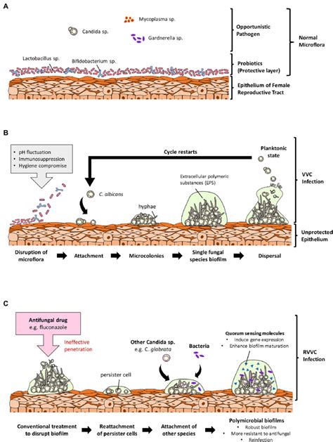 Overview Of The Role Of Fungal Biofilms In Vulvovaginal Candidiasis