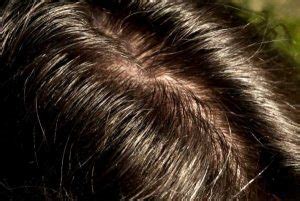 Inestetismi e malattie del capello: cause e cure adeguate.