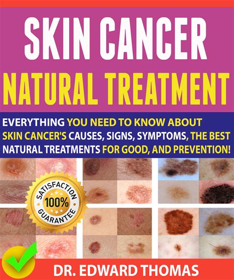Buy Skin Cancer Natural Everything You Need To Know About Skin Cancer