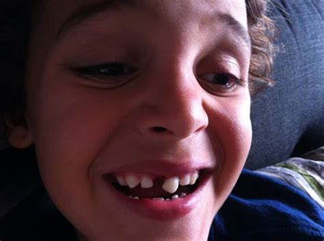 Pulling them out prematurely risks injury and infection. 8 Creative Ways To Pull A Loose Tooth