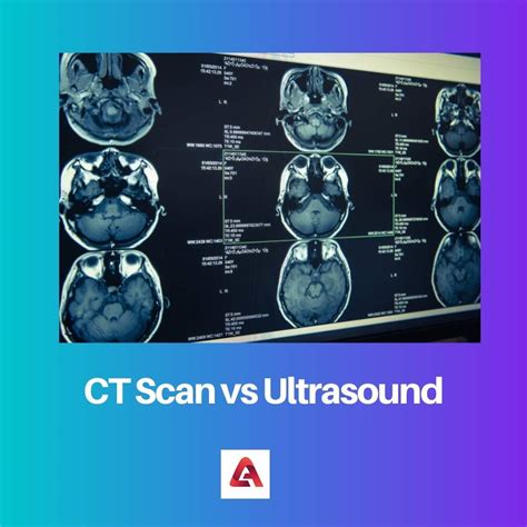 Ct Scan Dan Ultrasound Tabel Perbedaan Mereka Yang Mendasar ≡ Versus