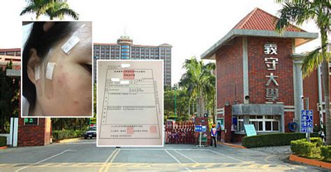 hk woman 21 attacked by roommate at taiwan university ejinsight