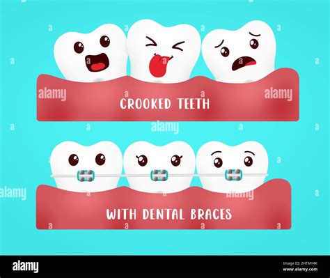 Emoji Dental Braces Vector Design Emojis Tooth With Dental Brace And