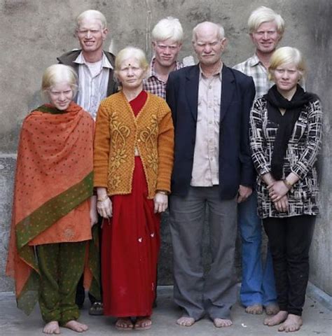Albinizm Albinizm W Ksi Dze Rekord W Guinnessa
