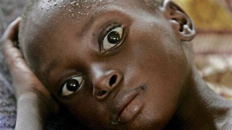 400000 Kindern Im Kongo Droht Der Hungertod