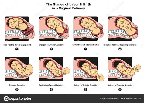 Stages Labor Birth Vaginal Delivery Infographic Diagram Including