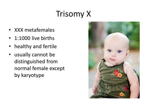 Ppt Down Syndrome Trisomy 21 Powerpoint Presentation Free Download