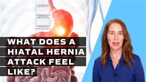 What Does A Hiatal Hernia Attack Feel Like 20 Symptoms