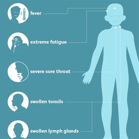Mononucleosis Symptoms 10 Signs And Symptoms Of Mononucleosis