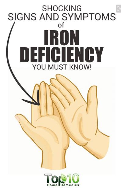 Awesome 10 Signs And Symptoms Of Iron Deficiency Health And Nutrition