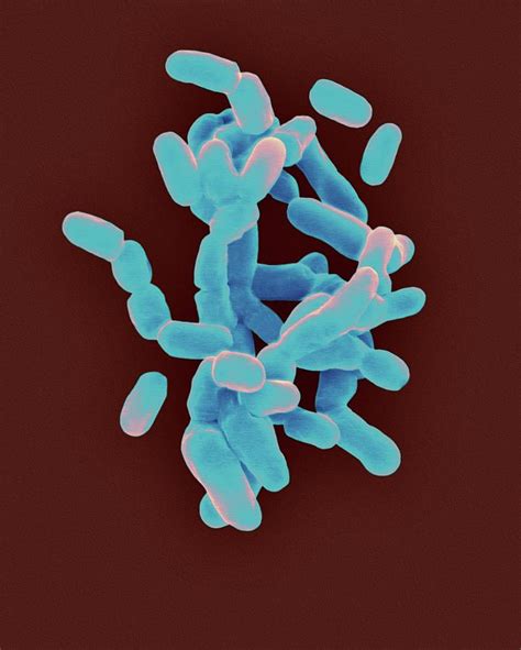 Gardnerella Vaginalis 2 Photograph By Dennis Kunkel Microscopyscience