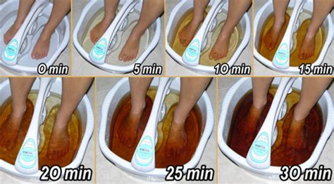 Detox Foot Spa Ionic Detoxification To Cleanse And Remove Toxins