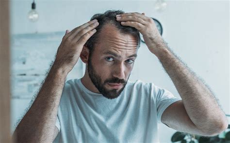 Hair Loss Treatment Options Hair Loss The Bald Company