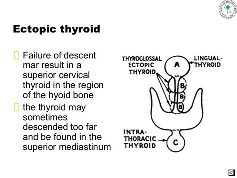 Anatomy Of Thyroid Gland