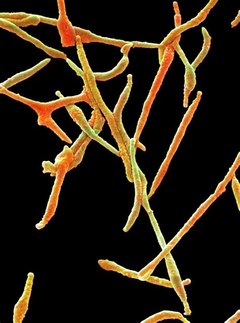 Mycoplasma Pneumoniae Photograph By Steve Gschmeissner Fine Art America