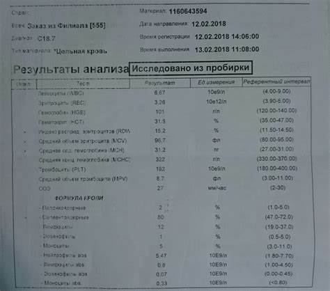 Рак сигмовидной кишки операция диета Рак сигмовидной кишки lll стадии, мчс в печени, асцит, - Вопрос Рак сигмовидной кишки lll стадии, мчс в печени, асцит, - Вопрос Рак сигмовидной кишки операция диета