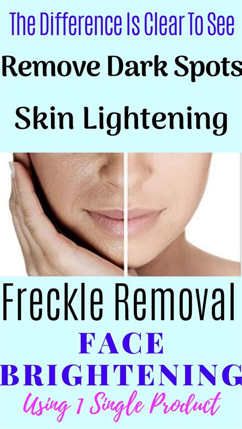 Dark skin whitening bleach bleaching cream lotion: Scobuty Skin Bleaching Cream[Best Dark Spot Remover ...