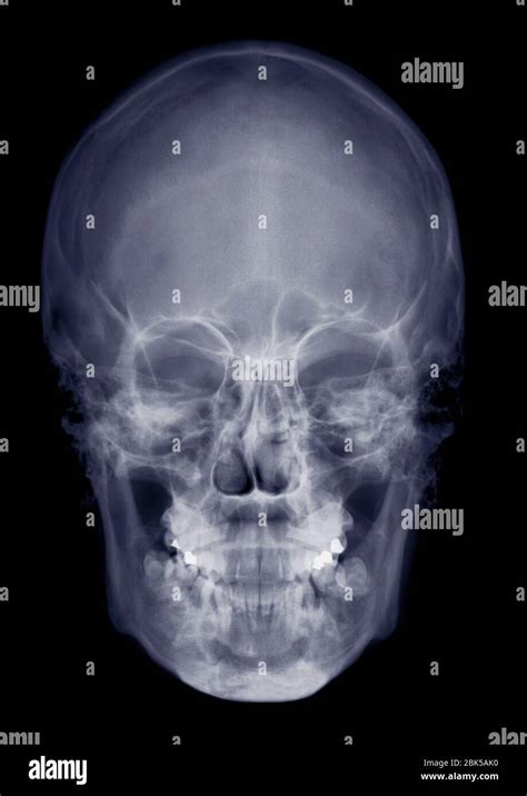 Skull Front View Hi Res Stock Photography And Images Alamy