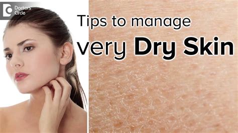 Dry Skin In All Seasons Causes And Its Management Dr Arti Priya R