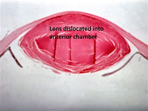 Moran Core Lens Histopathology